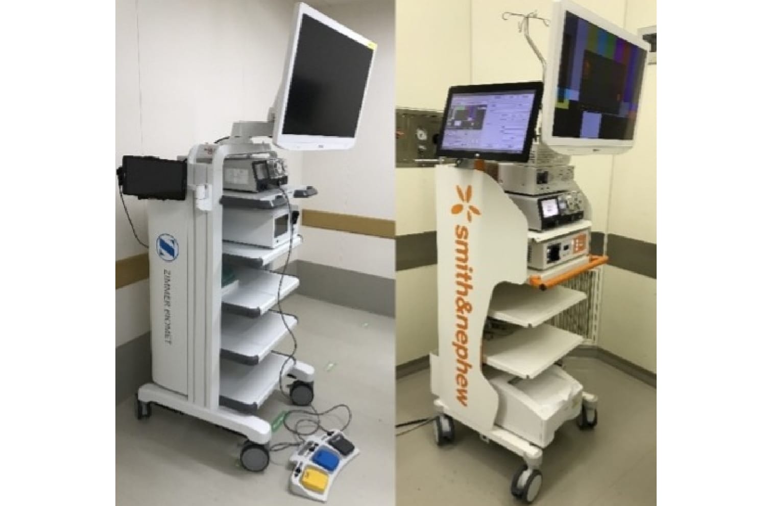 関節鏡視下手術